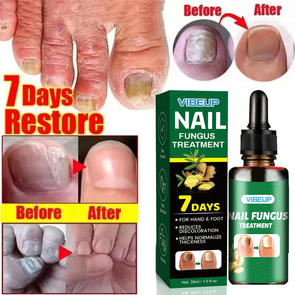 Sérum Réparateur Intense 7 Jours pour Ongles Mycosés ™