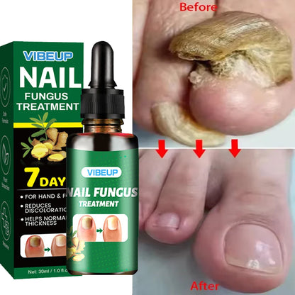 Sérum Réparateur Intense 7 Jours pour Ongles Mycosés ™