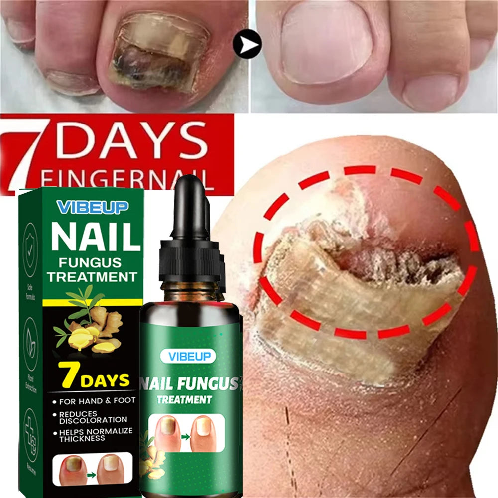 Sérum Réparateur Intense 7 Jours pour Ongles Mycosés ™