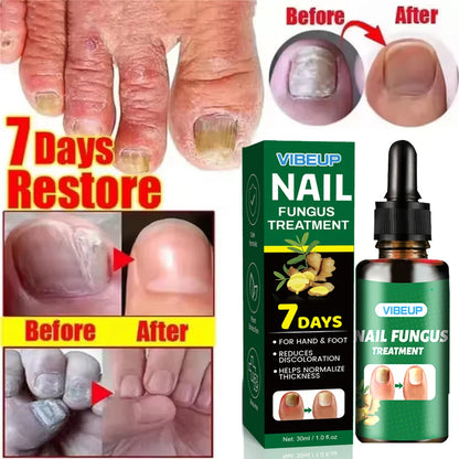 Sérum Réparateur Intense 7 Jours pour Ongles Mycosés ™