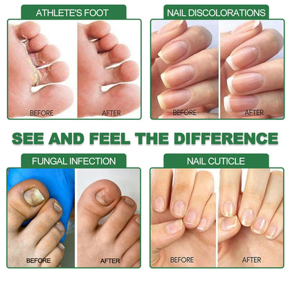 Sérum Réparateur Intense 7 Jours pour Ongles Mycosés ™